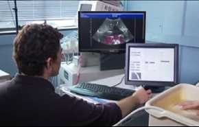 حصاة الكلى.. الاسباب والعلاج