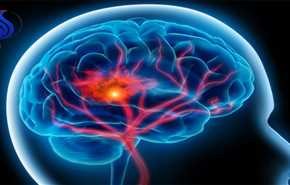 شناخت علائم خطر سکته مغزی