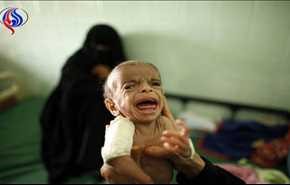 السعودية ومرتزقتها تقتل أطفال اليمن مرتين