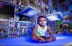 مرض نادر يجبر طفلا على البقاء تحت الضوء الأزرق + صور