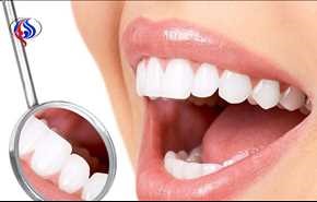 200 میلیون دندان پوسیده در دهان ایرانیان