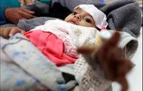 كوليرا عبر اليمن