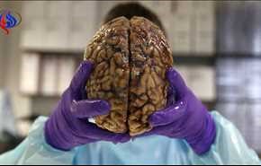 هذا هو أقدم دماغ اكتشفه علماء الاثار