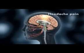 الصداع  النصفي