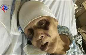 مسنة مصرية عذبها ابنها حتى الموت إرضاء لزوجته!