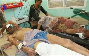 الأمم المتحدة تطلق تحقيقا دوليا في جرائم الحرب باليمن