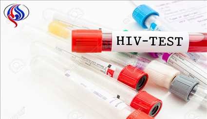 امیدی تازه برای از بین بردن ویروس ایدز