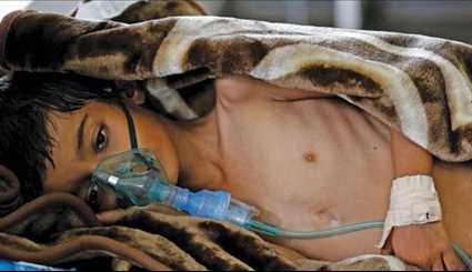وبا، قاتل بی رحم کودکان نجات یافته از جنگ در یمن