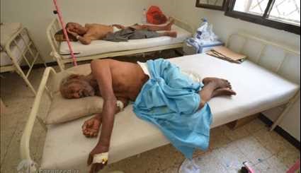 شیوع وبا در یمن