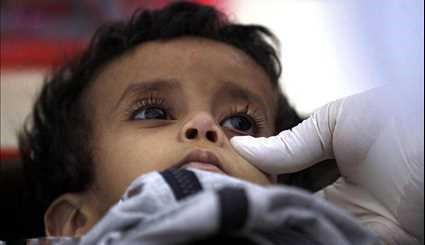 انتشار وباء الكوليرا في اليمن بسبب العدوان السعودي