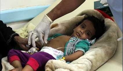 انتشار وباء الكوليرا في اليمن بسبب العدوان السعودي