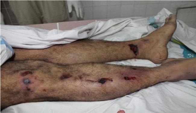 السلطات البحرينية لن تحقق في عمليات التعذيب