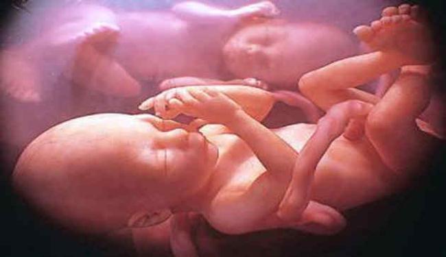 إبتكار طريقة جديدة في ايران لتحديد جنس الجنين