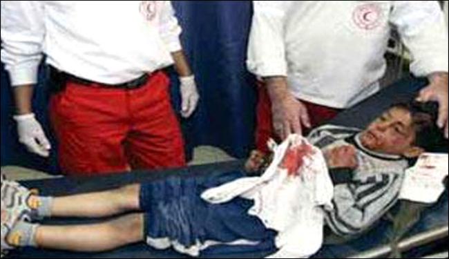 مستوطنون يعتدون على طفل فلسطيني بالقضبان الحديدية