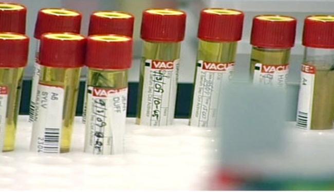 خلايا عصبية تنتج مباشرة من الجلد 