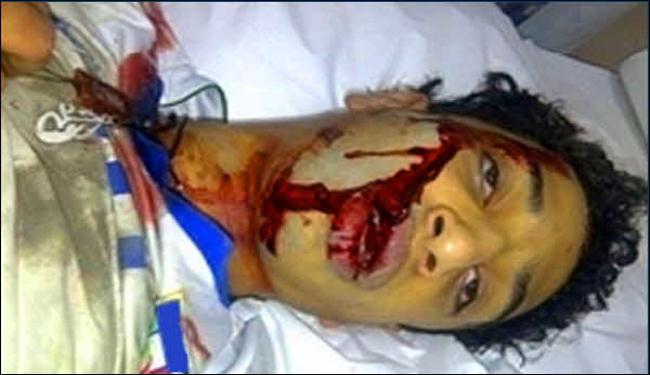 ايران تستنكر جريمة قتل فتى بحريني برصاص الامن