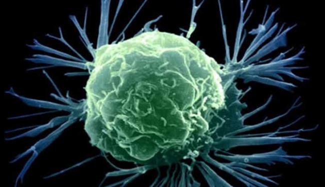 علماء يبتدعون أسلوباً جديداً لعلاج السرطان
