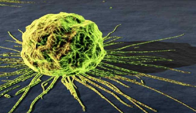 سرطان الثدي عند الرجال نادر لکنه أکثر فتکاً