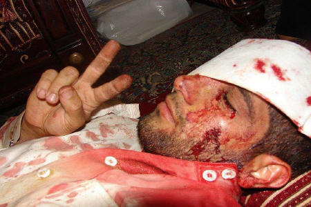 ده‌ها مجروح در حملات نیروهای آل‌خلیفه به مردم