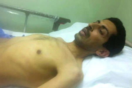 احتمال شهادت فعال بحرینی براثر اعتصاب غذا