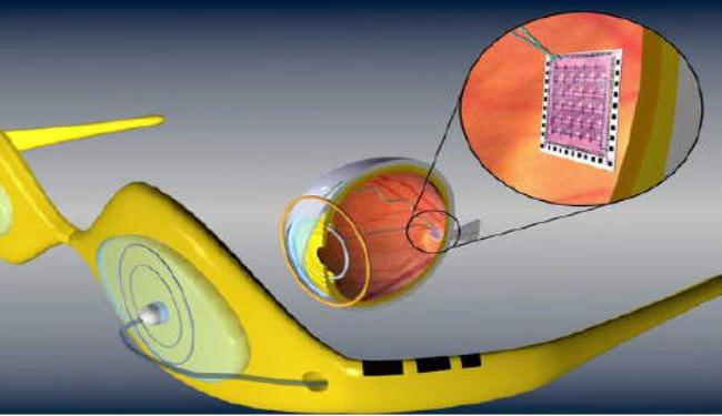 اول شبكية عين اصطناعية من خلايا جذعية باليابان