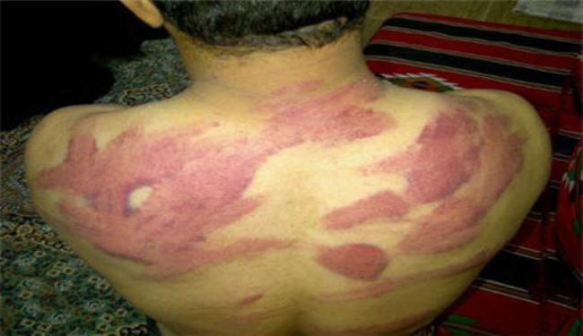 البحرينية لحقوق الإنسان تطالب بتوقيف مرتكبي التعذيب