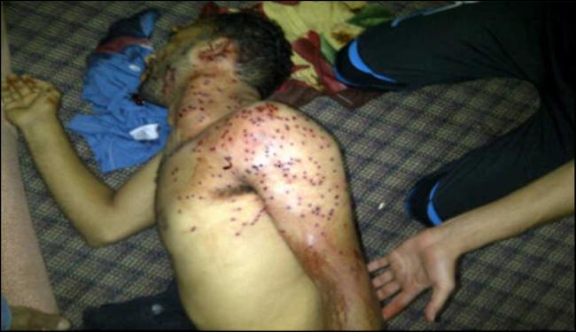 الأمن البحريني يصيب العشرات برصاص الشوزن بينهم طفل