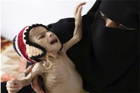 10 میلیون یمنی گرسنه می‌خوابند