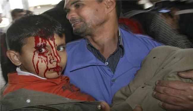 المقاومة الفلسطينية كان ردها قويا على العدوان الاسرائيلي