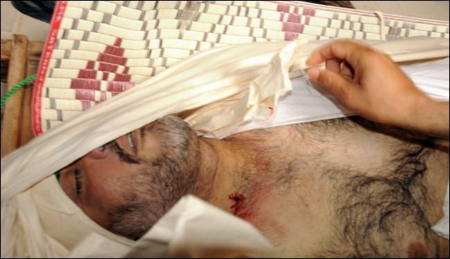 التعذيب ممنهج بالبحرين والنيابة غيرته لتهمة الضرب