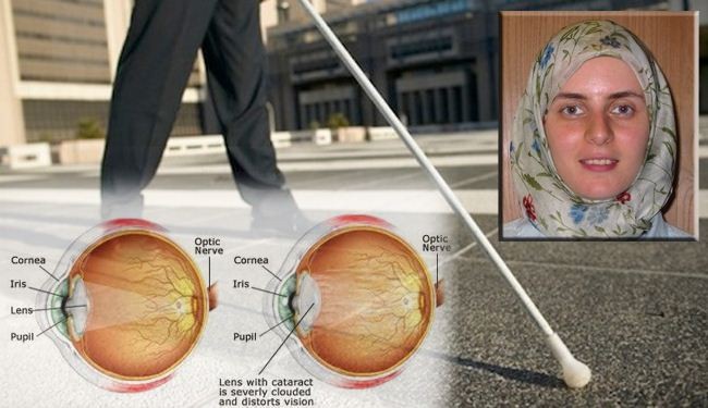 عالمة ايرانية تكتشف أسلوبا جديدا لعلاج العمى