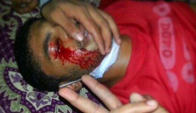 البحرين: سقوط عشرات الجرحى على يد قوات النظام