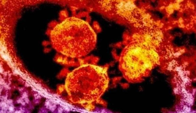اكتشاف 12 حالة من فيروس شبيه بسارس في العالم