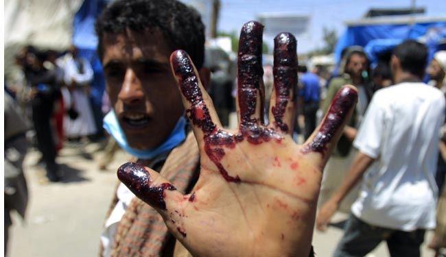 افزایش درگیری،امدادرسانی درشمال یمن را مختل کرد