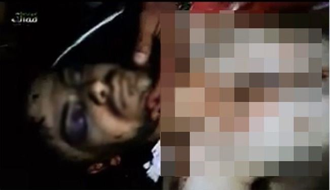 سرقت‌اعضای‌ بدن زخمی‌های‌ سوری‌ در ‌ترکیه