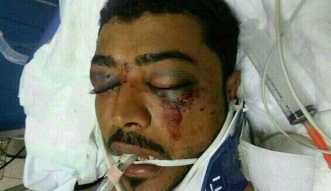 خودداری آل خلیفه از تحویل پیکر شهید بحرینی