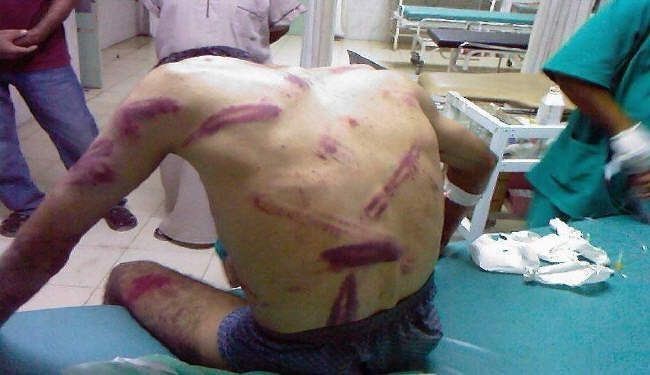 شکنجه 1600فعال بحرینی در سال جاری میلادی