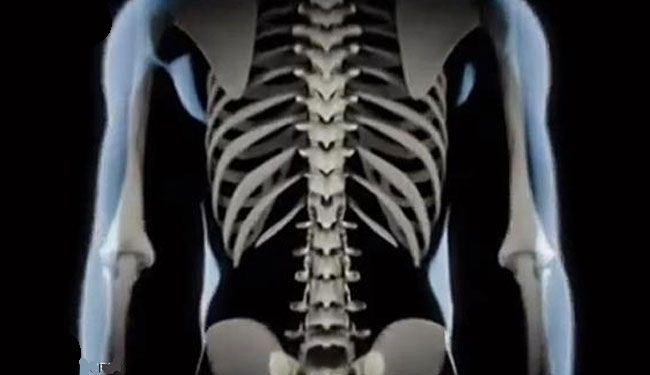 هشاشة العظام تزيد مخاطر الصمم المفاجئ