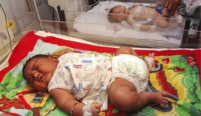 تصاویر تولد نوزاد 5.8 کیلوگرمی در هند