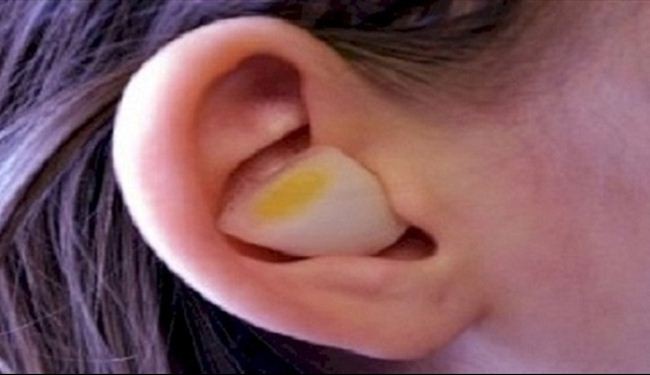 هذا ما يحصل عند وضع البصل في أذنيك لليلة كاملة!