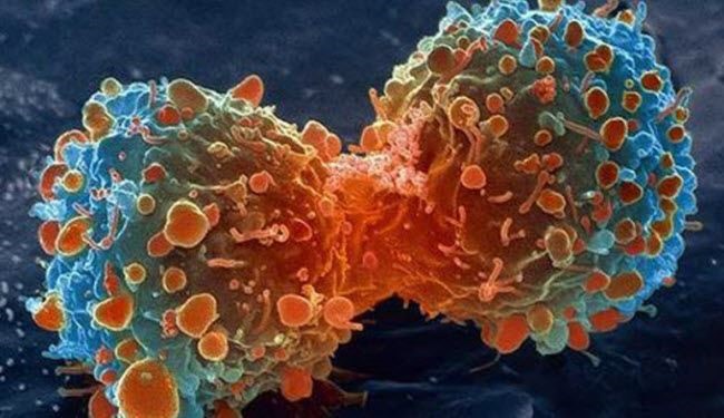 4 مهن تحفز الأورام السرطانية