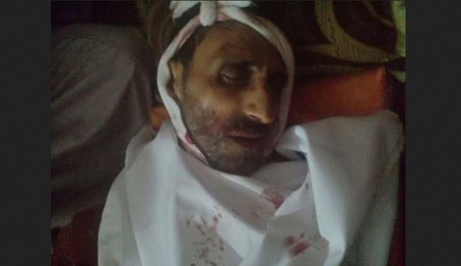 اغتيال قيادي اخواني بارز بمدينة ذمار اليمنية