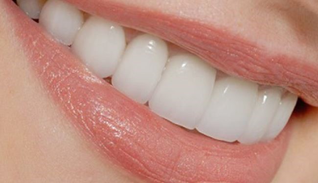 نسخه جادویی آسان برای داشتن دندان های سفید