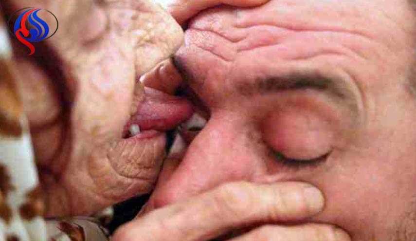 عجوز بوسنية تستخدم لسانها لعلاج مرضاها من العمى