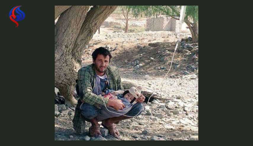 شاهد بالصورة بدون تعليق... هذا حال اطفال اليمن