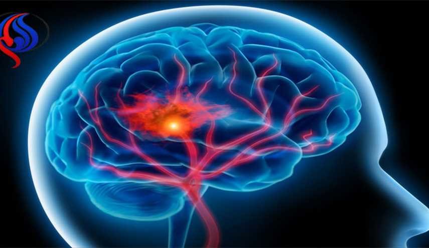 شناخت علائم خطر سکته مغزی
