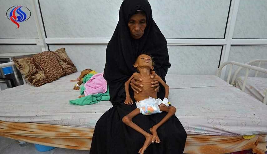 الفاو تحذر من كارثة إنسانية في اليمن بسبب المجاعة