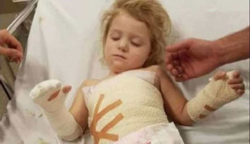 هذه الطفلة كادت أن تخسر يدها بسبب شيء خطير موجود في منازلكم!