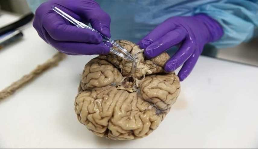 علماء يفكون لغزا كبيرا حيرهم إلى يومنا هذاحول الدماغ.. ما هو؟