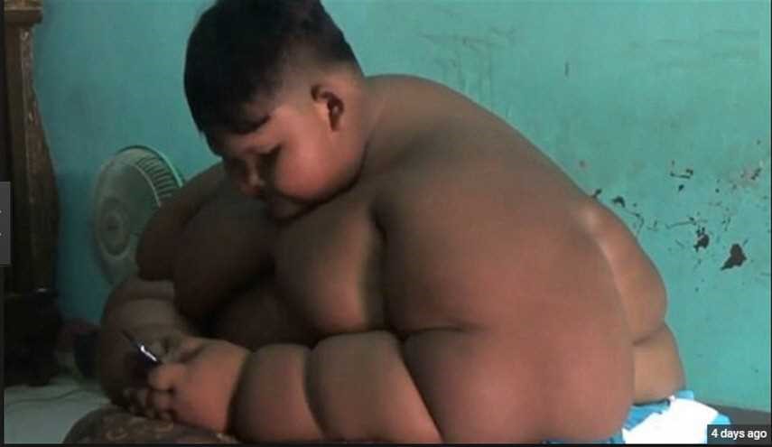 بالصور- طفل يزن 190 كيلوغراماً... ماذا فعل له الأطباء؟